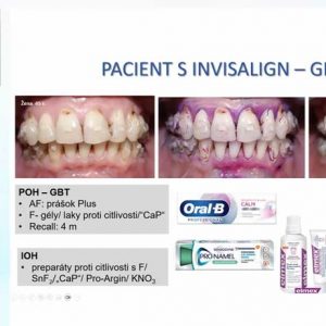 Webinář: Starostlivosť u pacienta pred a počas čeľustno – ortopedickej liečby od  Kristiny Zimmermann